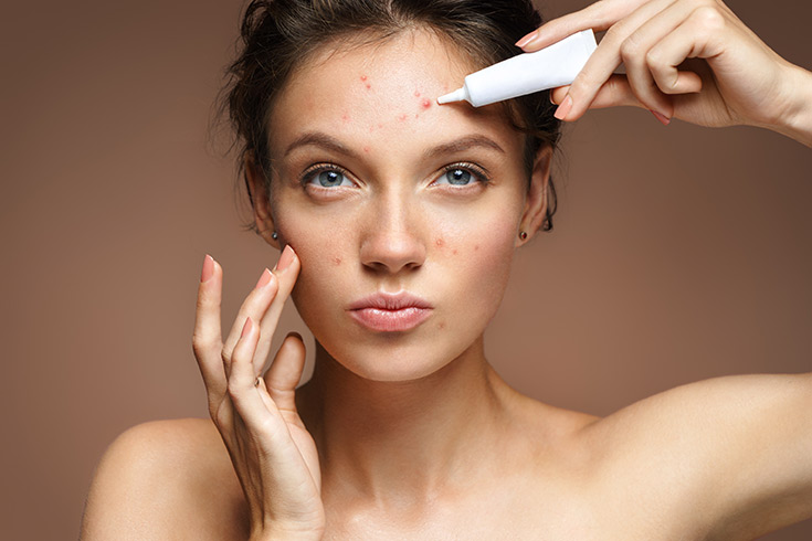 A woman puts cream on a skin blemish.